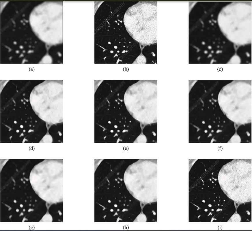 CT Deblurring Comparison