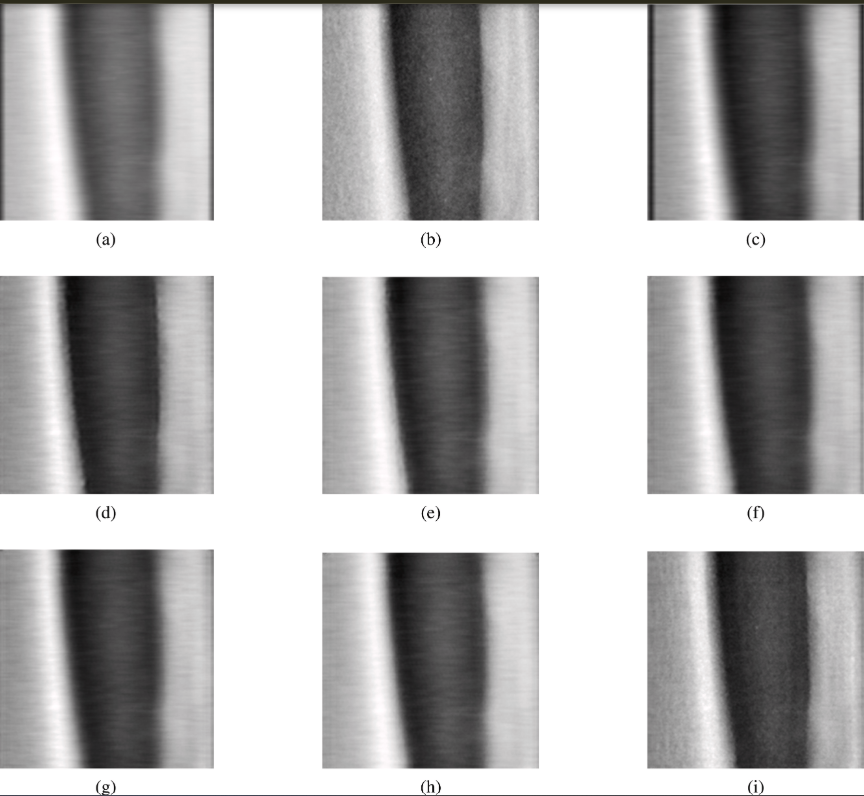 DXA Scan Comparison